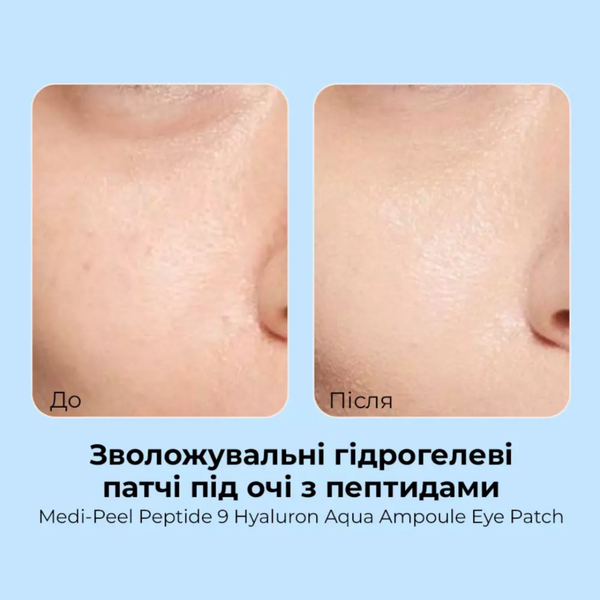 Зволожувальні патчі з пептидами Medi-Peel Hyaluron Aqua Peptide 9 Ampoule Eye Patch | 60 шт cos544 фото