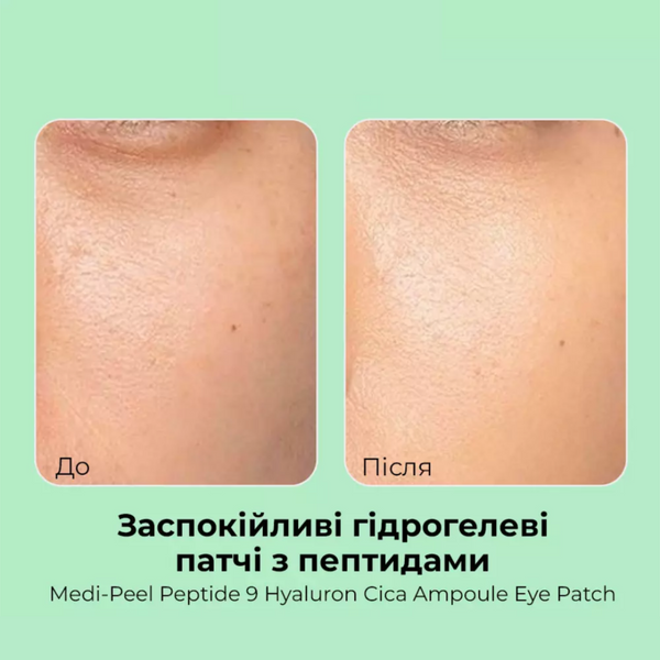 Заспокійливі патчі з пептидами Medi-Peel Hyaluron Cica Peptide 9 Ampoule Eye Patch | 60 шт cos545 фото