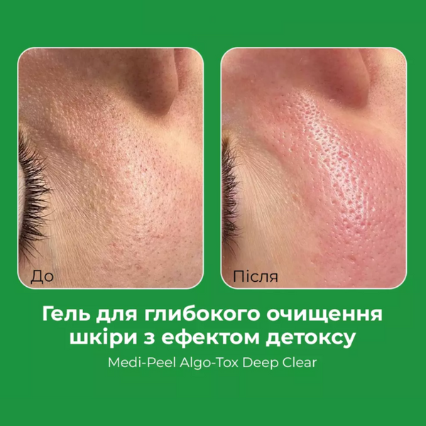 Гель для глибокого очищення шкіри з детокс дією Medi-Peel Algo-Tox Deep Clear cos549 фото