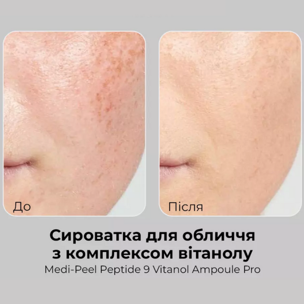 Освітлююча сироватка з 20% ніацинаміду та комплексом вітанолу Medi-Peel Peptide 9 Vitanol Ampoule Pro cos552 фото
