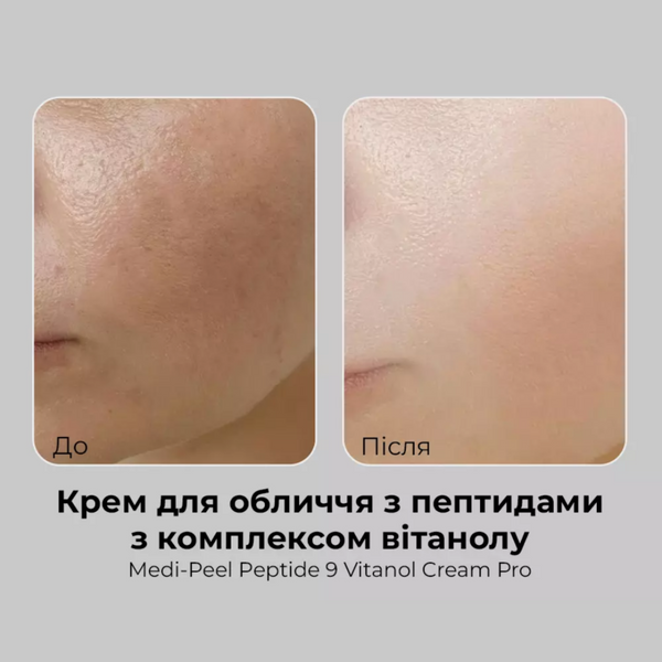 Освітлюючий крем з 12% ніацинаміду та комплексом вітанолу Medi-Peel Peptide 9 Vitanol Cream Pro cos554 фото