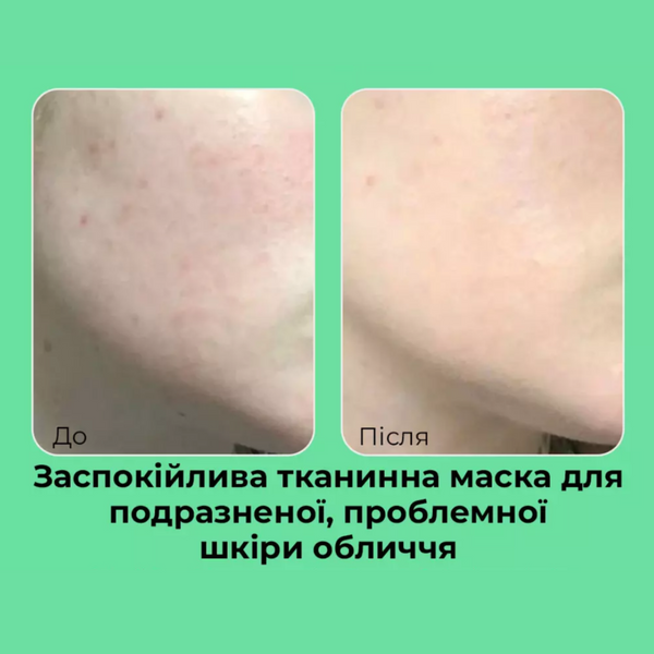 Заспокійлива тканинна маска з центеллою MEDIPEEL Bamboo Cica Bomb Calming Mask cos732 фото