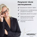 Антивікова сироватка для шкіри навколо очей Medi-Peel Mezzo Filla Eye Serum cos557 фото 6