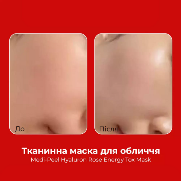 Зволожуюча тканинна маска з колагеном MEDIPEEL Hyaluron Rose Energy Tox Mask cos733 фото